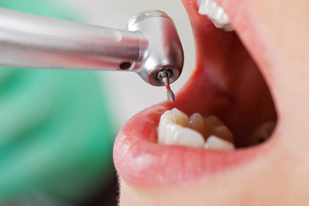 Best Emergency Treatment for Oral Infections in Sneedville, TN